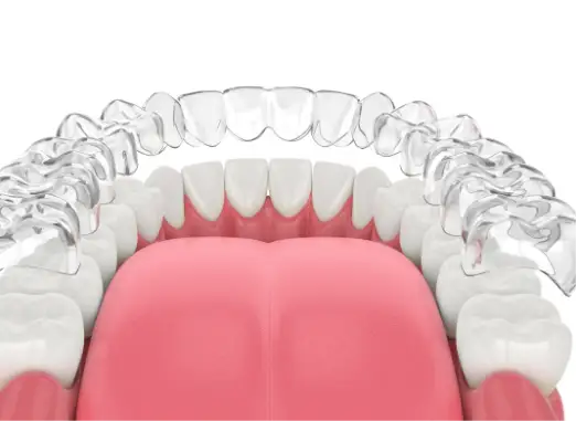 Dental Implant Restorations